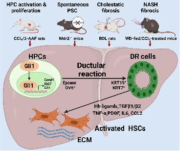 刘平教授团队研究成果揭示Gli1蛋白介导肝祖细胞发生胆管反应加重肝纤维化的新机制